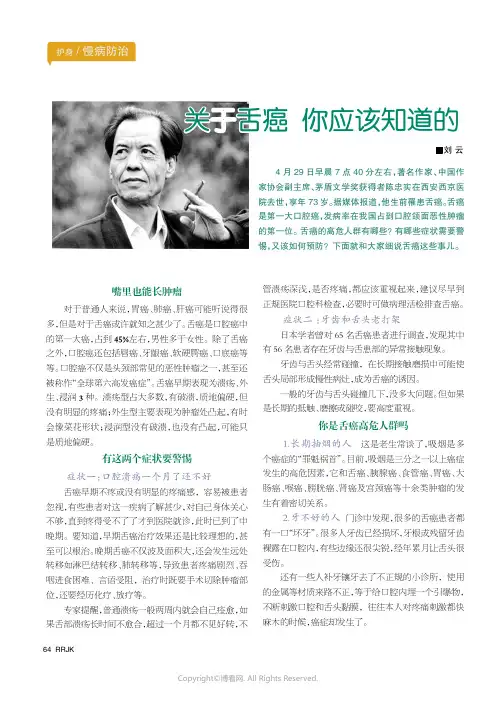 关于舌癌你应该知道的