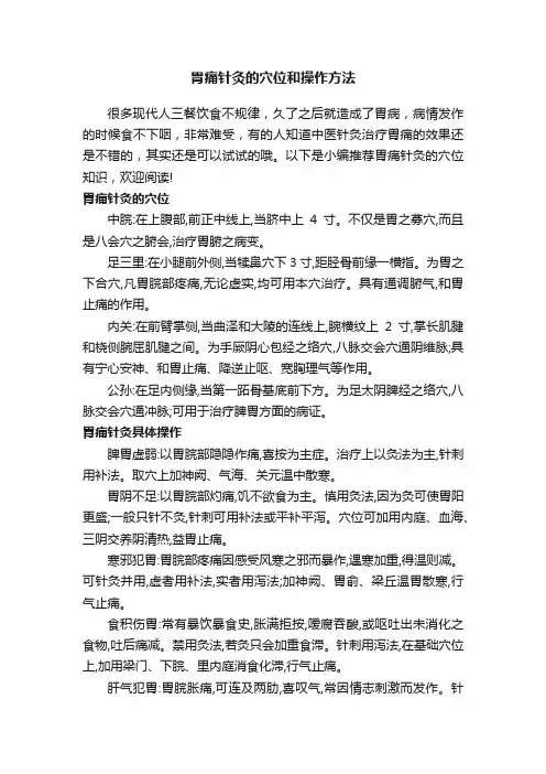 胃痛针灸的穴位和操作方法