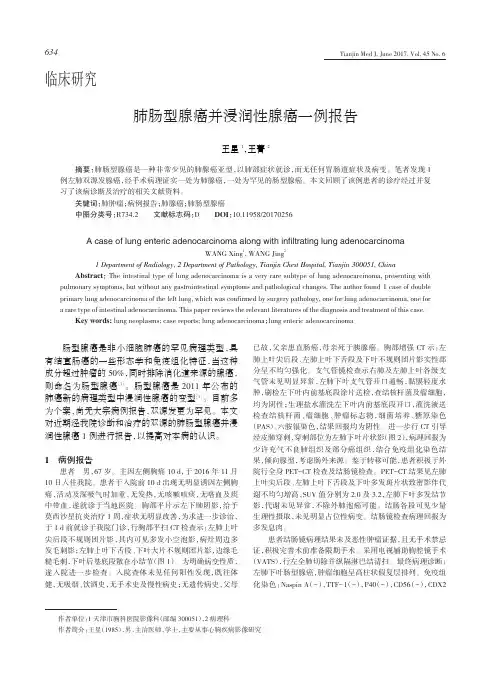 肺肠型腺癌并浸润性腺癌一例报告