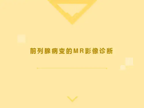 前列腺癌MRI影像诊断