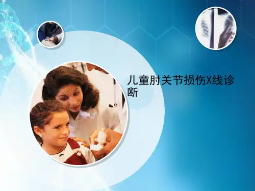儿童肘关节损伤X线诊断ppt课件