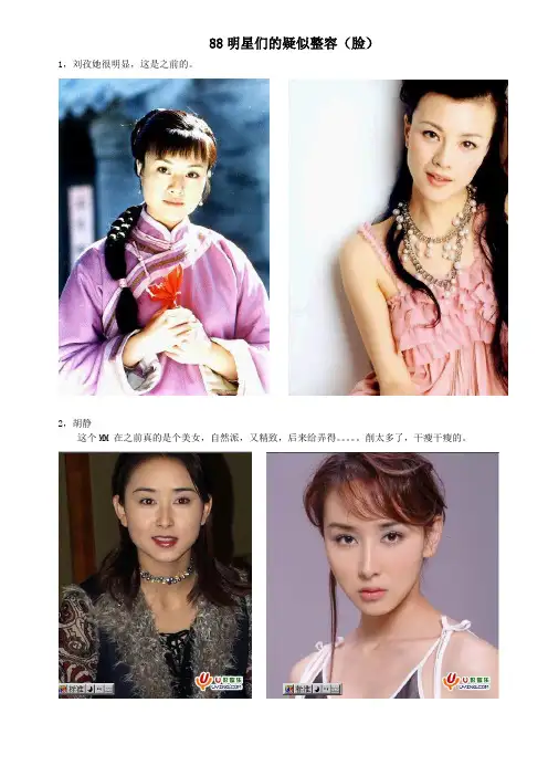 88明星们的疑似整容(脸).doc