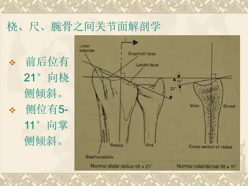 桡骨远端关节内骨折ppt课件