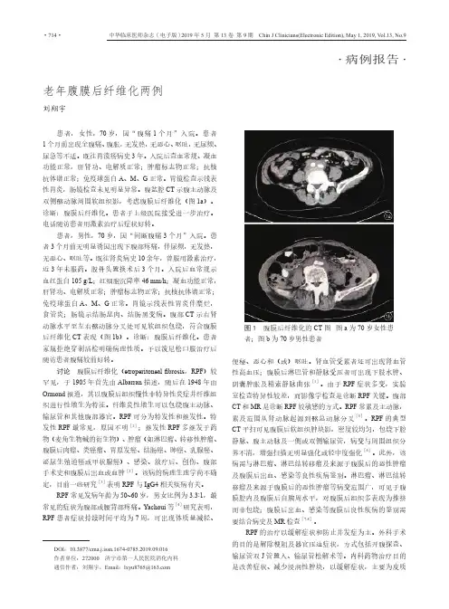老年腹膜后纤维化两例