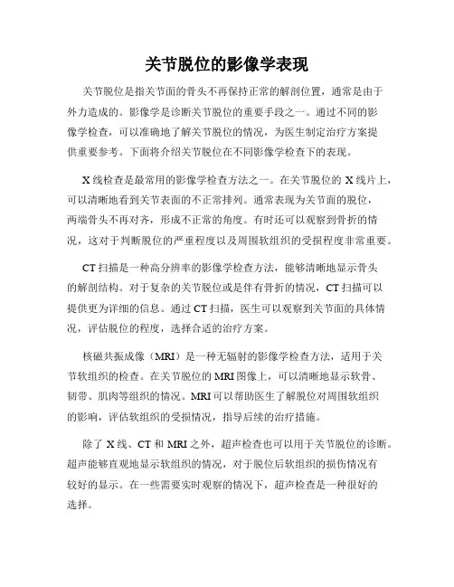 关节脱位的影像学表现