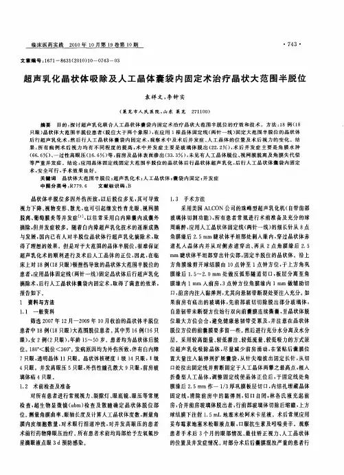 超声乳化晶状体吸除及人工晶体囊袋内固定术治疗晶状大范围半脱位