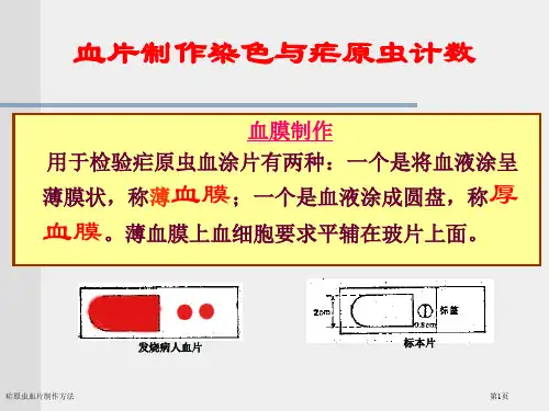疟原虫血片制作方法
