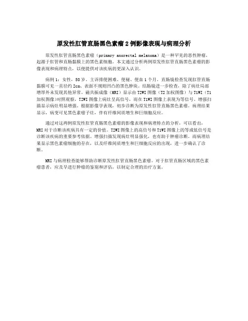 原发性肛管直肠黑色素瘤2例影像表现与病理分析
