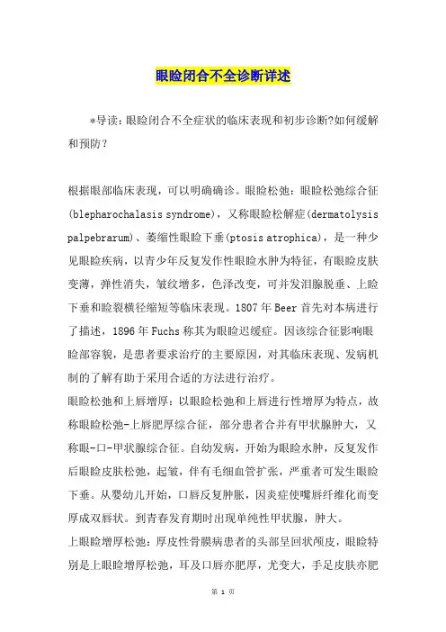 眼睑闭合不全诊断详述