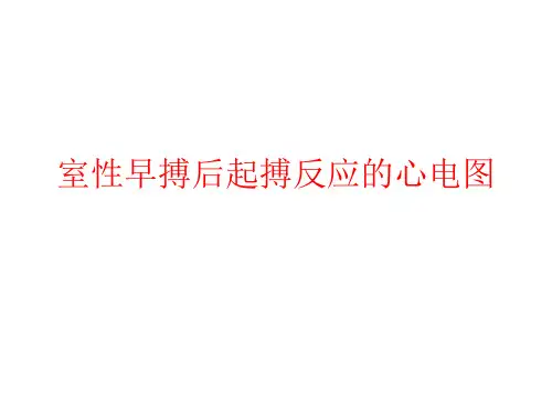 室性早搏后起搏反应的心电图