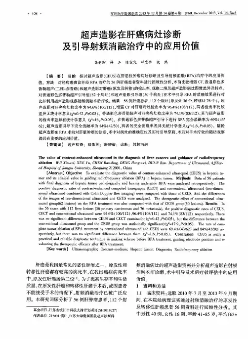 超声造影在肝癌病灶诊断及引导射频消融治疗中的应用价值
