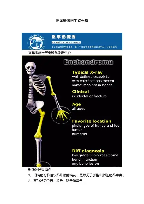 临床影像内生软骨瘤