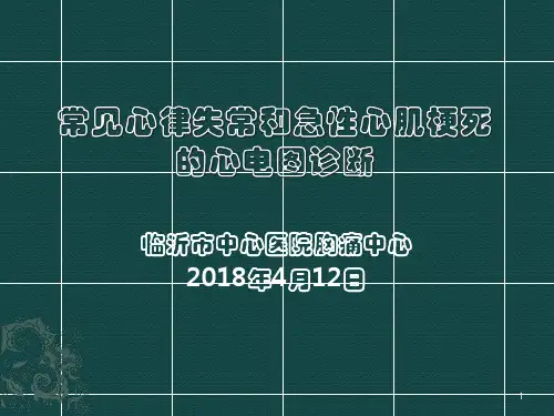 常见心律失常和急性心肌梗死的心电图诊断