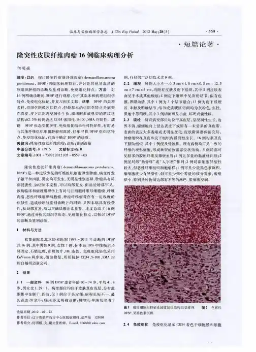 隆突性皮肤纤维肉瘤16例临床病理分析