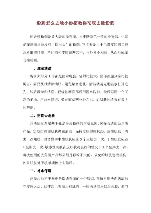 粉刺怎么去除小妙招 教你彻底去除粉刺