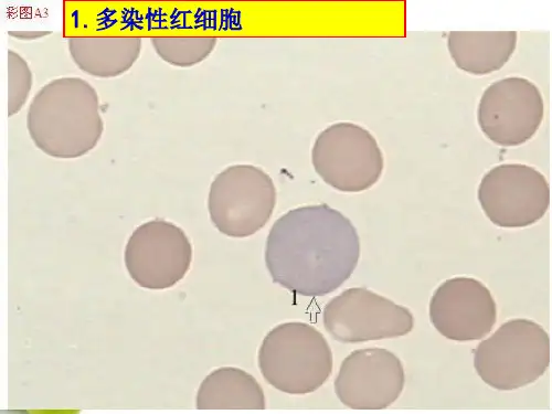 骨髓细胞图谱PPT012