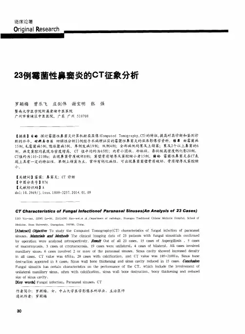23例霉菌性鼻窦炎的CT征象分析