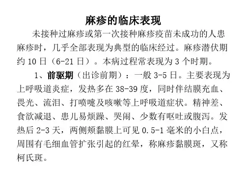 麻疹的临床表现