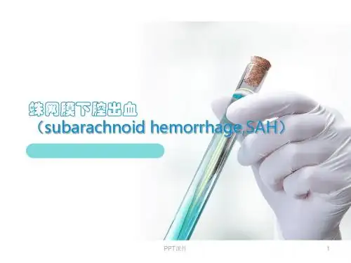 蛛网膜下腔出血  ppt课件