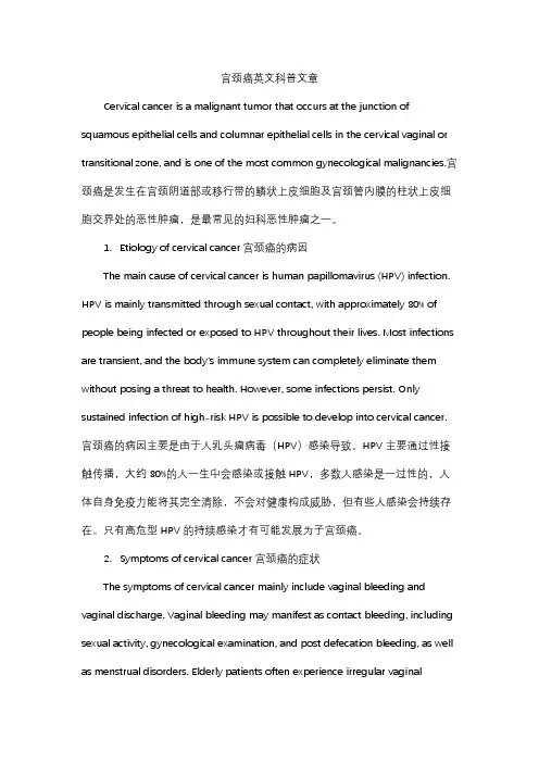 宫颈癌英文科普文章