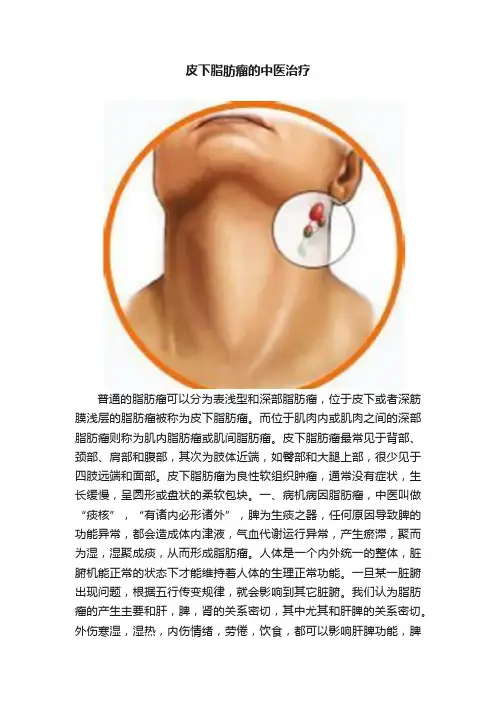 皮下脂肪瘤的中医治疗