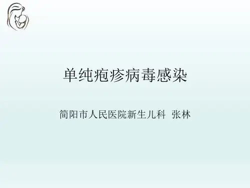 单纯疱疹病毒感染
