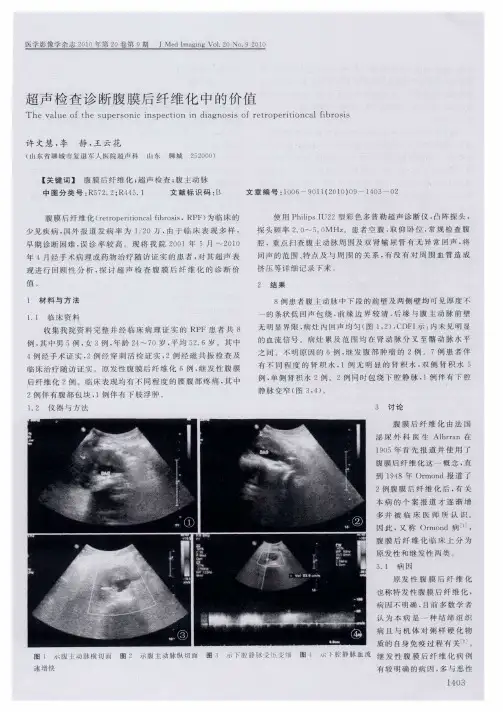 超声检查诊断腹膜后纤维化中的价值