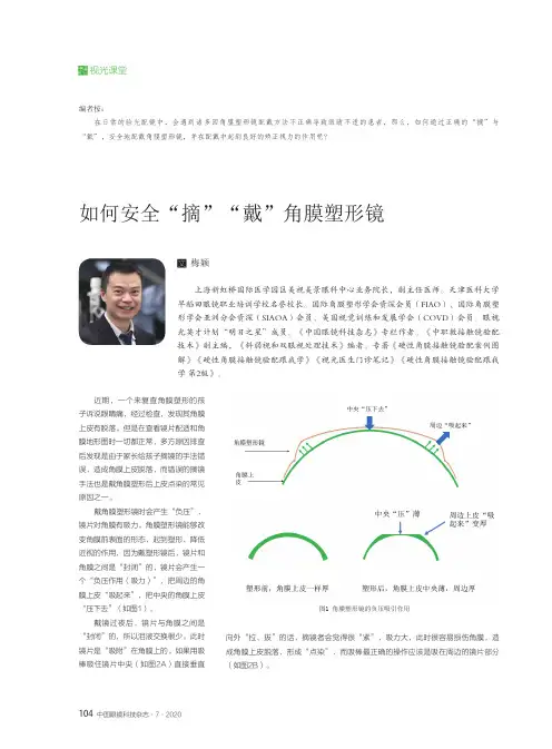 如何安全“摘”“戴”角膜塑形镜