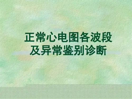 正常心电图各波段及异常鉴别诊断