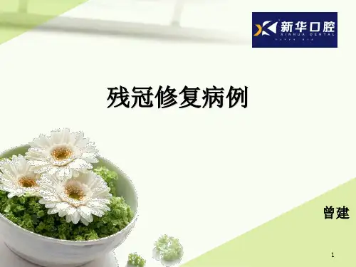 残冠修复病例ppt课件