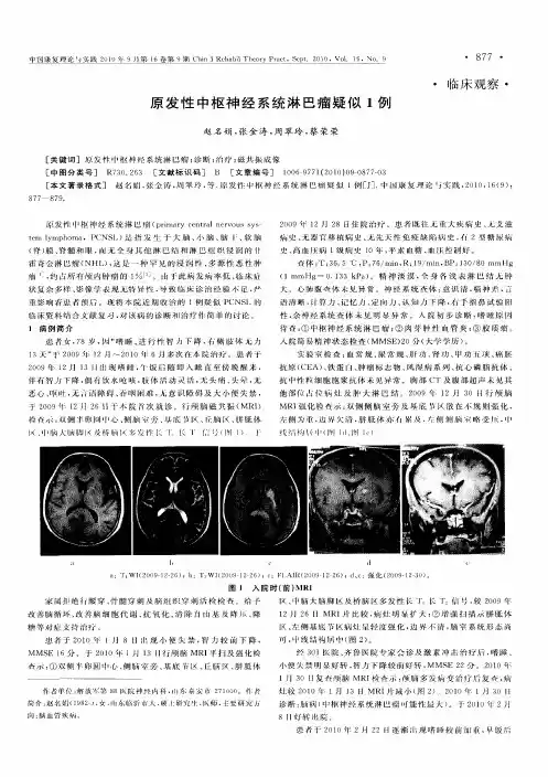 原发性中枢神经系统淋巴瘤疑似1例