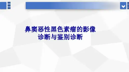鼻窦恶性黑色素瘤的影像诊断与鉴别诊断