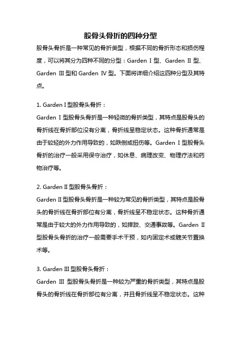 股骨头骨折的四种分型