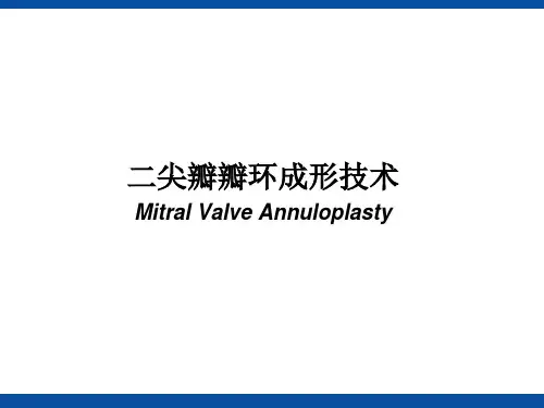 二尖瓣瓣环成形技术