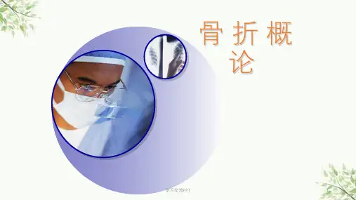 骨折概论讲义医学课件