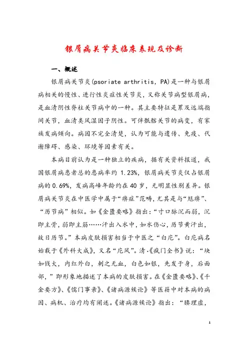 银屑病关节炎临床表现及诊断
