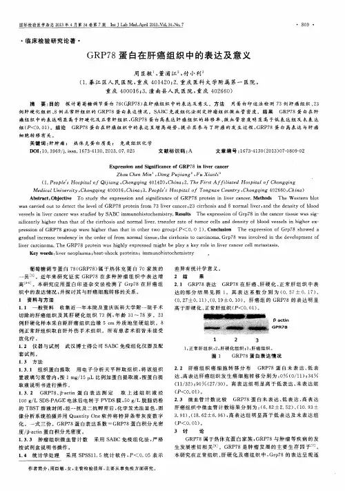 GRP78蛋白在肝癌组织中的表达及意义