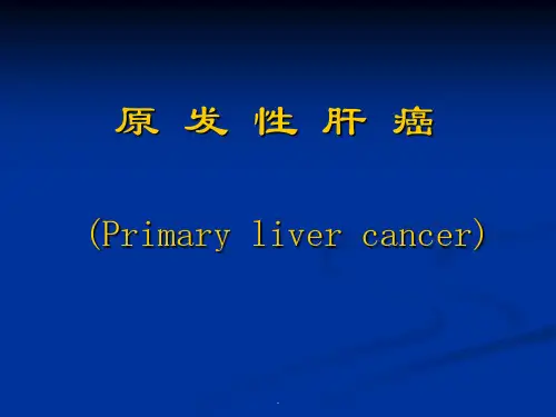 (推荐下载)肝 癌PPT演示课件