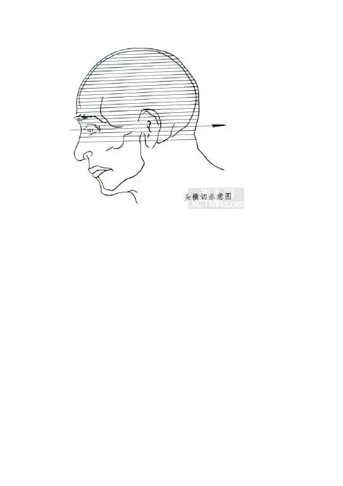 头(颅脑)横断位标本解剖