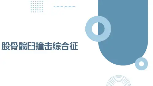 股骨髋臼撞击综合征