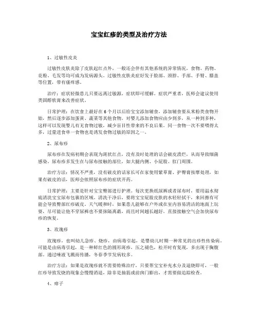 宝宝红疹的类型及治疗方法