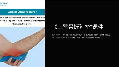 《上臂骨折》课件