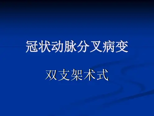 冠脉分叉病变术式