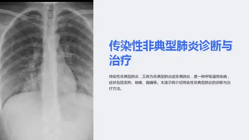 传染性非典型肺炎诊断与治疗