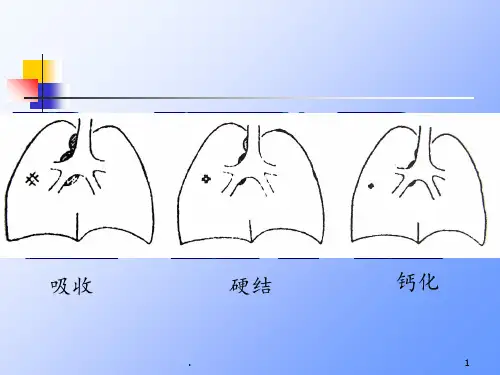 抗结核治疗PPT课件