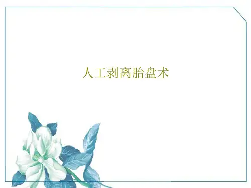 人工剥离胎盘术共19页