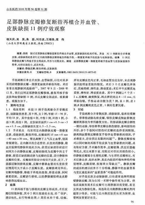 足部静脉皮瓣修复断指再植合并血管、皮肤缺损11例疗效观察