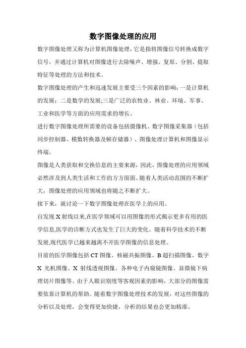 数字图像处理在医学上的应用