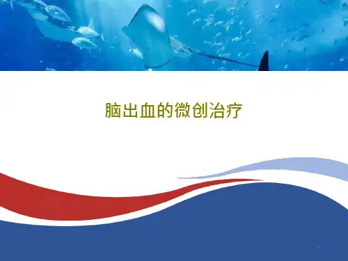 脑出血的微创治疗课件