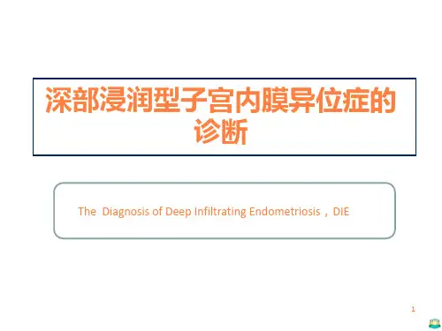 深部浸润型子宫内膜异位症的诊断ppt课件